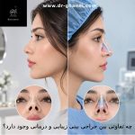 چه تفاوتی بین جراحی بینی زیبایی و درمانی وجود دارد؟