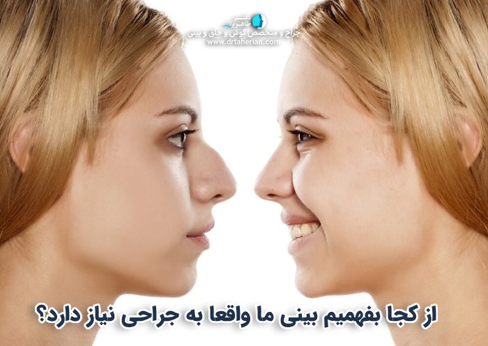 از کجا بفهمیم بینی ما واقعا به جراحی نیاز دارد؟