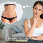 تصورات اشتباه در مورد لیپوساکشن