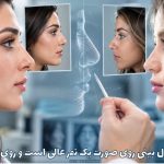 چرا یک مدل بینی روی صورت یک نفر عالی است و روی دیگری نه؟